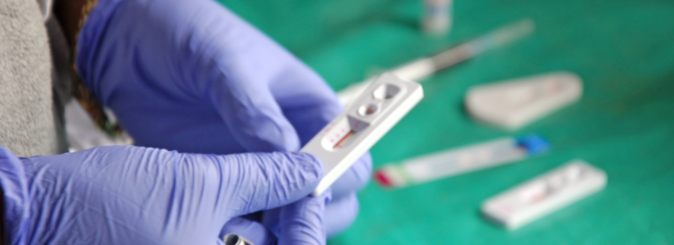HIV Aids testing